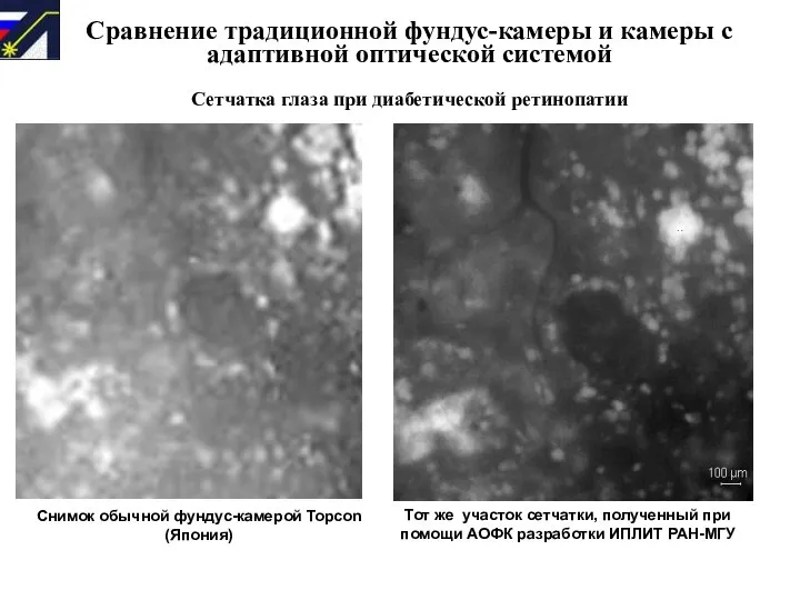 Сравнение традиционной фундус-камеры и камеры с адаптивной оптической системой Сетчатка глаза