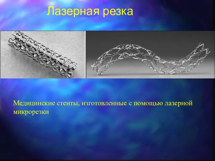 Лазерная резка Медицинские стенты, изготовленные с помощью лазерной микрорезки