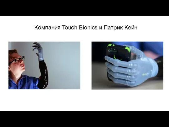 Компания Touch Bionics и Патрик Кейн