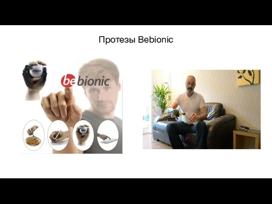 Протезы Bebionic