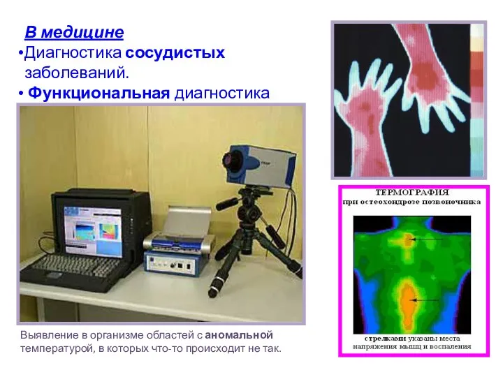 В медицине Диагностика сосудистых заболеваний. Функциональная диагностика Выявление в организме областей