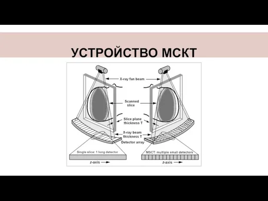 УСТРОЙСТВО МСКТ