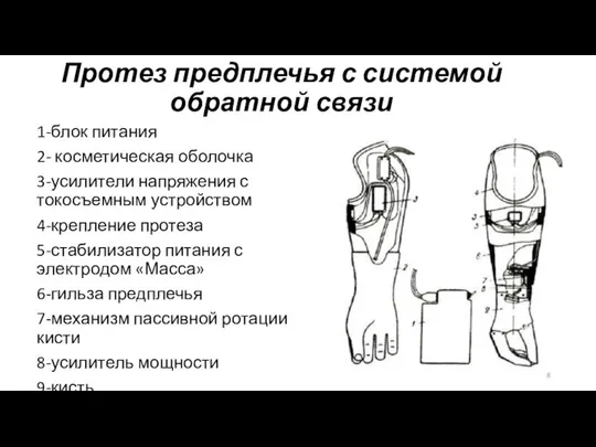 Протез предплечья с системой обратной связи 1-блок питания 2- косметическая оболочка