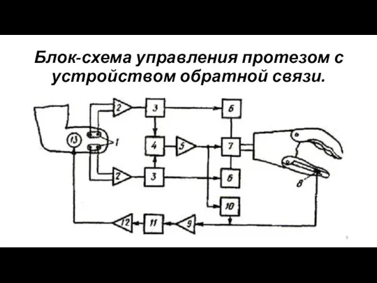 Блок-схема управления протезом с устройством обратной связи.