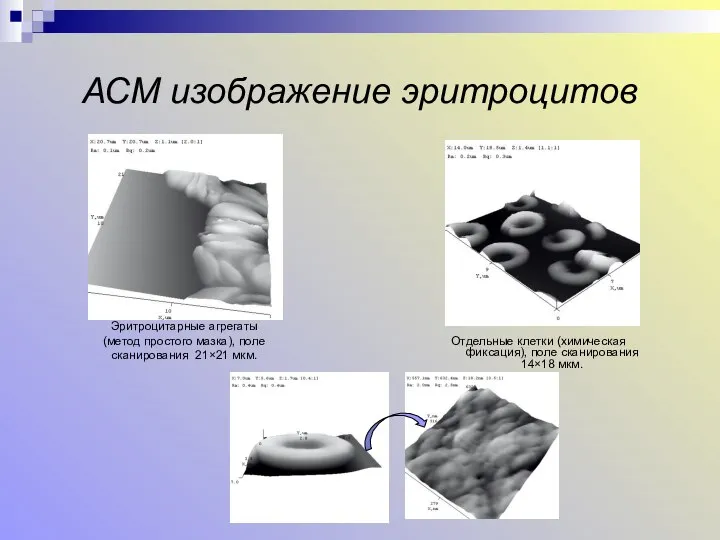 АСМ изображение эритроцитов Отдельные клетки (химическая фиксация), поле сканирования 14×18 мкм.