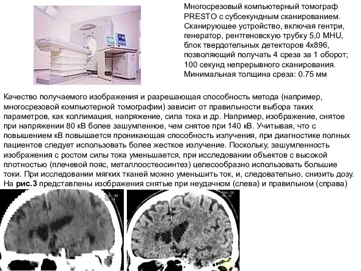 Многосрезовый компьютерный томограф PRESTO с субсекундным сканированием. Сканирующее устройство, включая гентри,