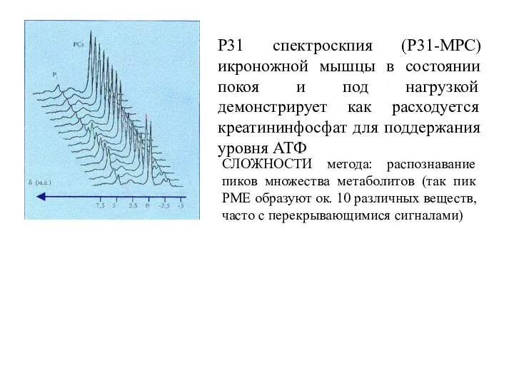 Р31 спектроскпия (Р31-МРС) икроножной мышцы в состоянии покоя и под нагрузкой