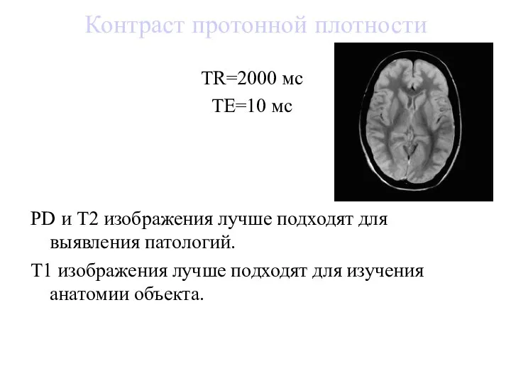 Контраст протонной плотности PD и Т2 изображения лучше подходят для выявления