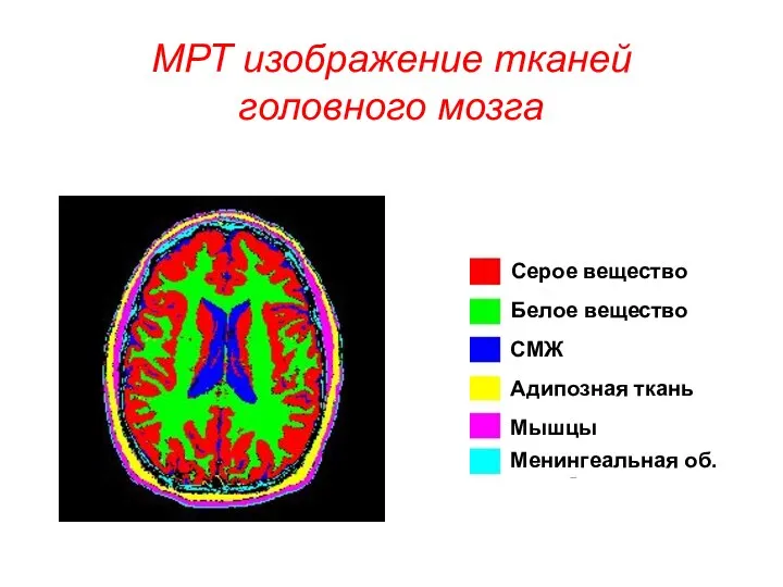 МРТ изображение тканей головного мозга