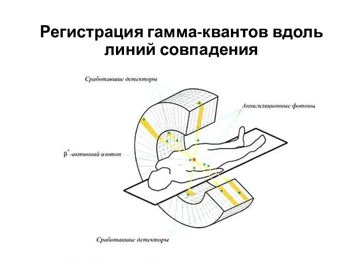 Регистрация гамма-квантов вдоль линий совпадения