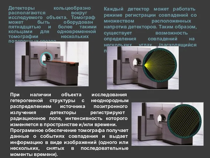 Детекторы кольцеобразно располагаются вокруг исследуемого объекта. Томограф может быть оборудован пятнадцатью