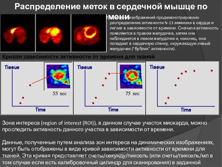 Распределение меток в сердечной мышце по времени На серии изображений продемонстрировано