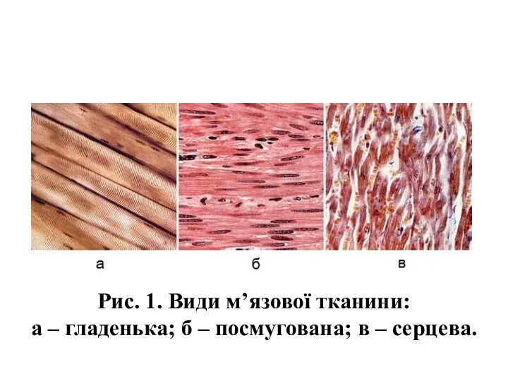 Рис. 1. Види м’язової тканини: а – гладенька; б – посмугована; в – серцева.