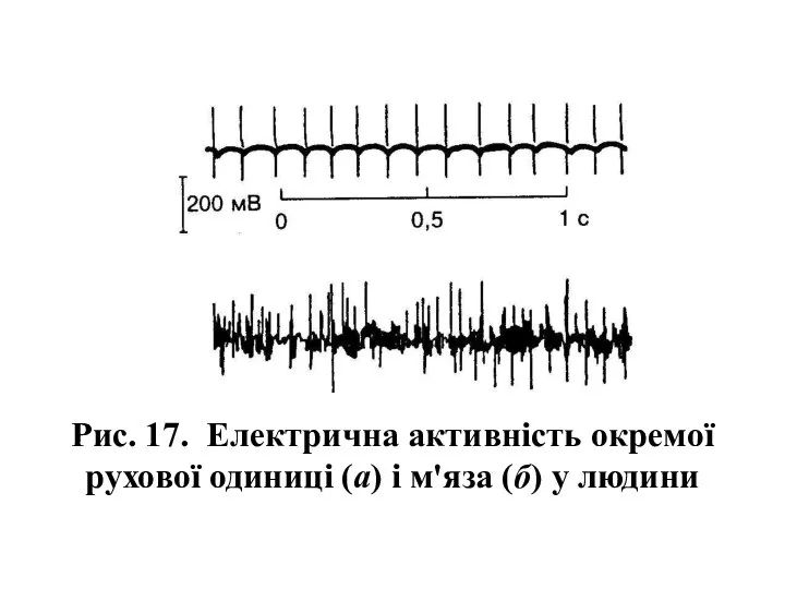 Рис. 17. Електрична активність окремої рухової одиниці (а) і м'яза (б) у людини