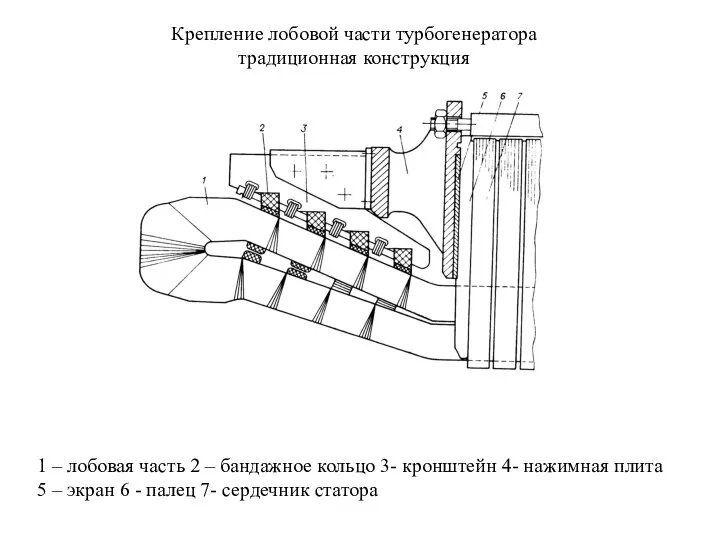 Крепление лобовой части турбогенератора традиционная конструкция 1 – лобовая часть 2