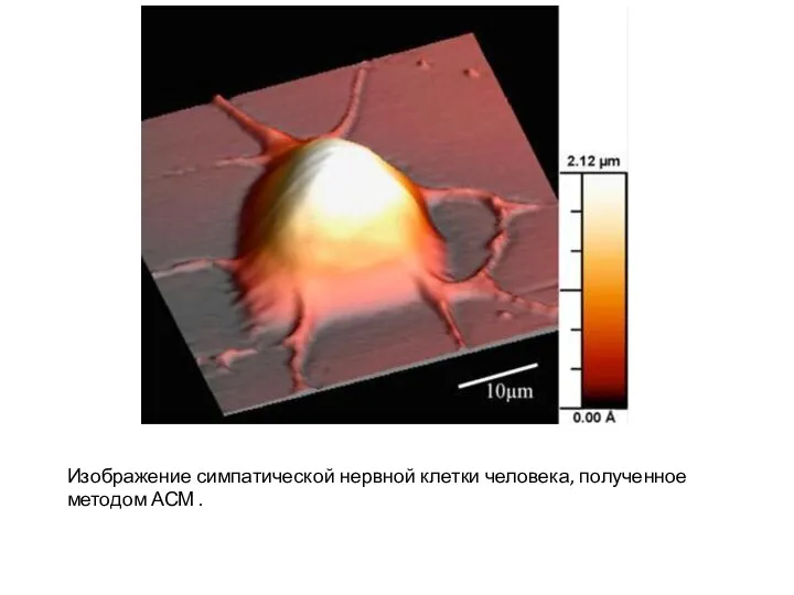 Изображение симпатической нервной клетки человека, полученное методом АСМ .