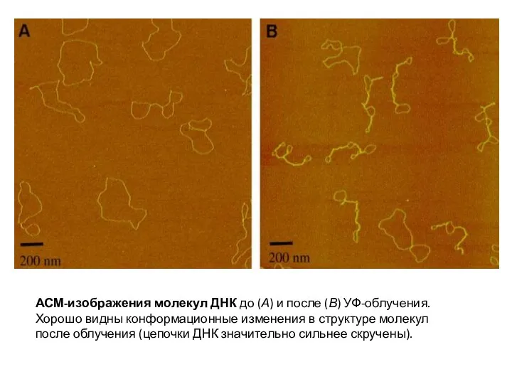 АСМ-изображения молекул ДНК до (А) и после (В) УФ-облучения. Хорошо видны