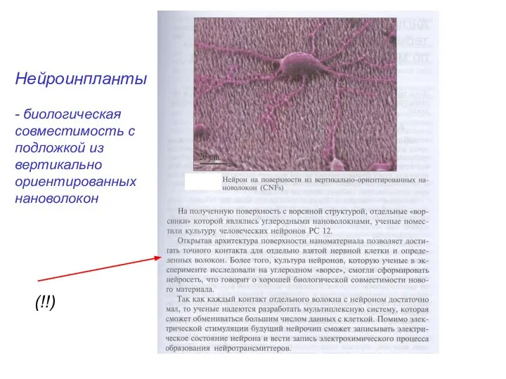 Нейроинпланты - биологическая совместимость с подложкой из вертикально ориентированных нановолокон (!!)