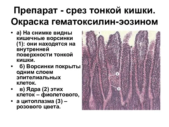 Препарат - срез тонкой кишки. Окраска гематоксилин-эозином а) На снимке видны