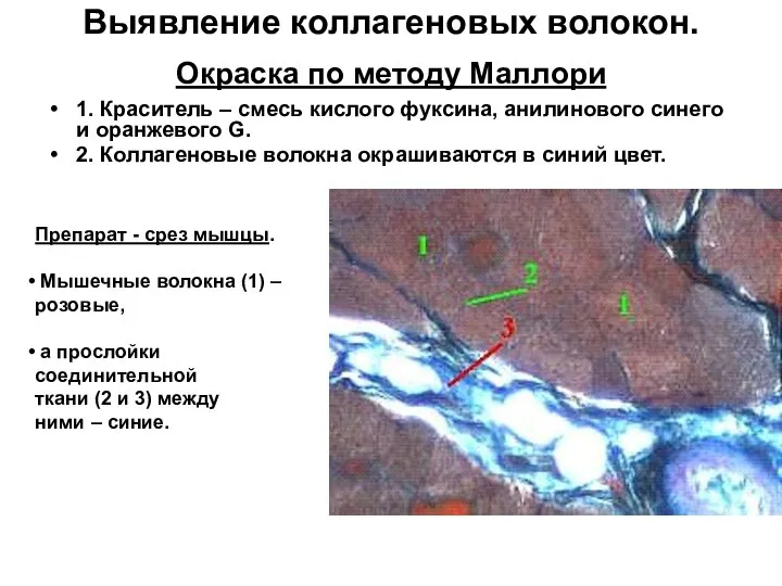 Выявление коллагеновых волокон. Окраска по методу Маллори 1. Краситель – смесь