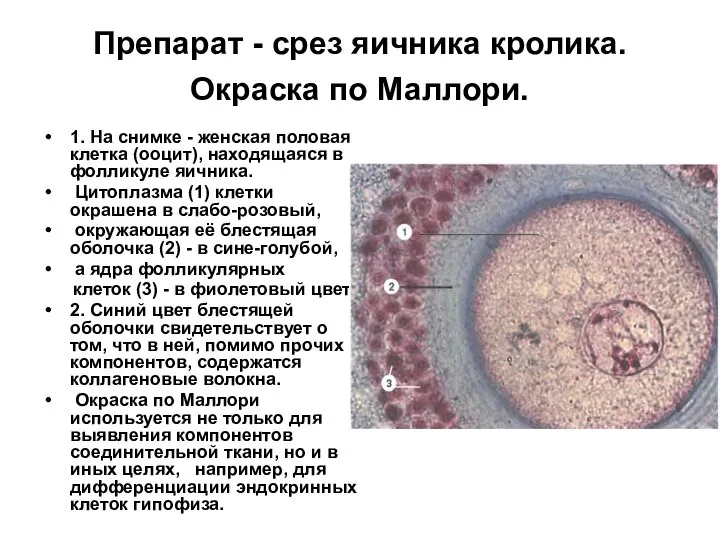 Препарат - срез яичника кролика. Окраска по Маллори. 1. На снимке