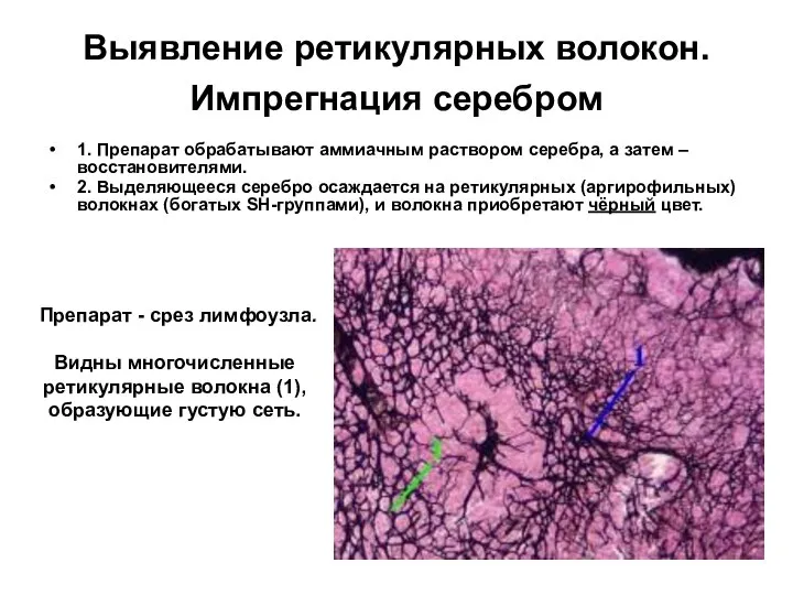 Выявление ретикулярных волокон. Импрегнация серебром 1. Препарат обрабатывают аммиачным раствором серебра,