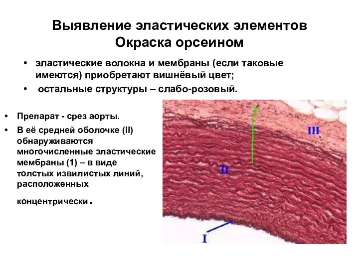 Выявление эластических элементов Окраска орсеином эластические волокна и мембраны (если таковые