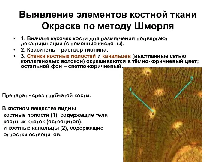 Выявление элементов костной ткани Окраска по методу Шморля 1. Вначале кусочек