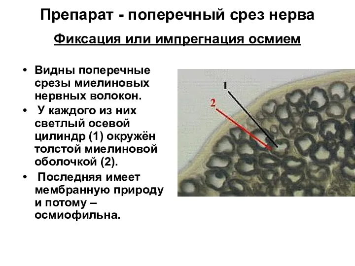 Препарат - поперечный срез нерва Фиксация или импрегнация осмием Видны поперечные