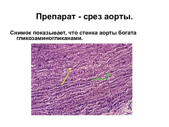 Препарат - срез аорты. Снимок показывает, что стенка аорты богата гликозаминогликанами.