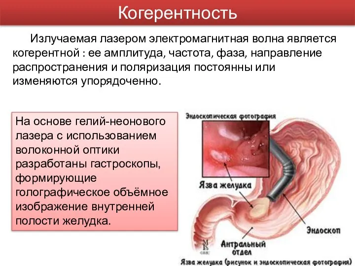 Когерентность Излучаемая лазером электромагнитная волна является когерентной : ее амплитуда, частота,