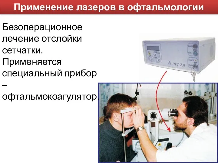 Применение лазеров в офтальмологии Безоперационное лечение отслойки сетчатки. Применяется специальный прибор – офтальмокоагулятор.