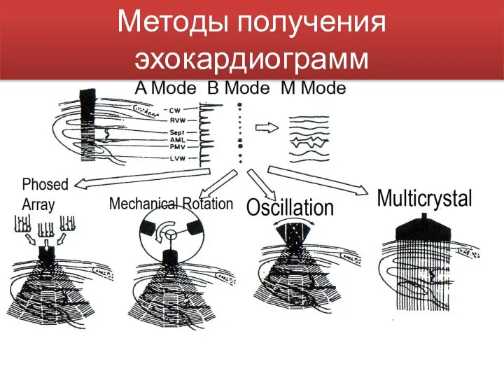 Методы получения эхокардиограмм