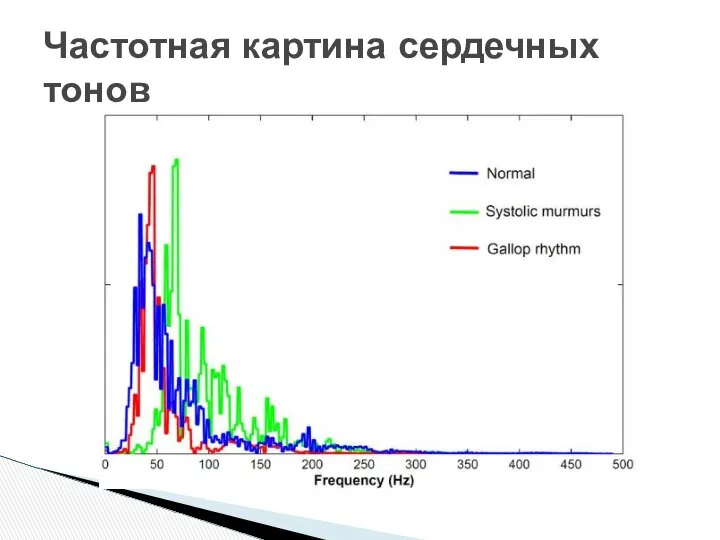 Частотная картина сердечных тонов