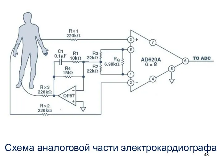 Схема аналоговой части электрокардиографа