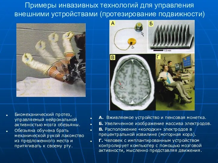 Примеры инвазивных технологий для управления внешними устройствами (протезирование подвижности) Биомеханический протез,