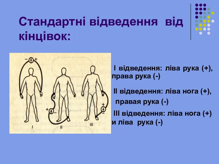 Стандартні відведення від кінцівок: II відведення: ліва нога (+), правая рука