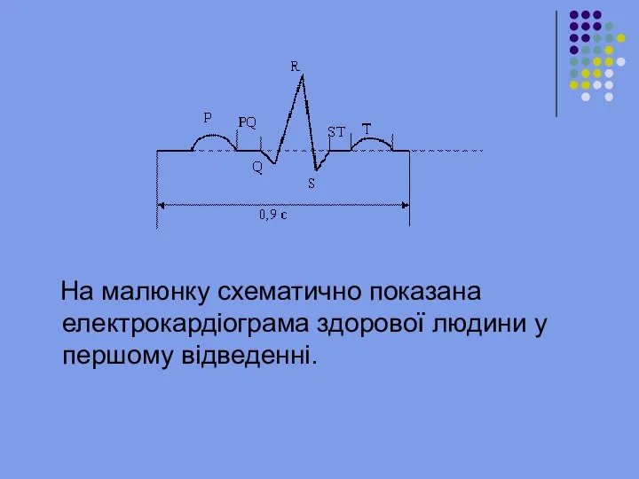 На малюнку схематично показана електрокардіограма здорової людини у першому відведенні.