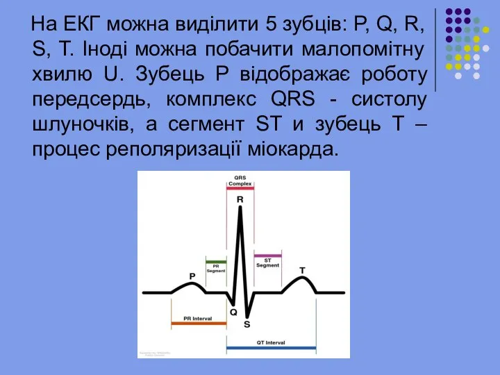 На ЕКГ можна виділити 5 зубців: P, Q, R, S, T.