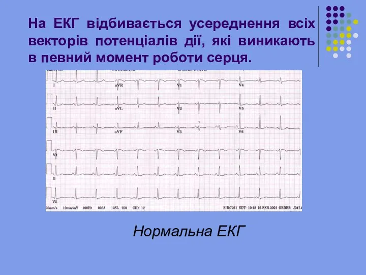 На ЕКГ відбивається усереднення всіх векторів потенціалів дії, які виникають в