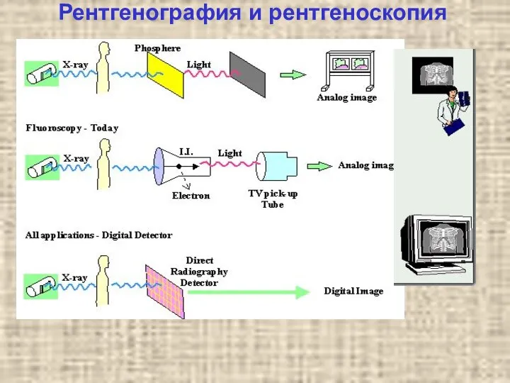 Рентгенография и рентгеноскопия