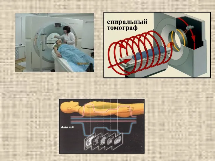 спиральный томограф