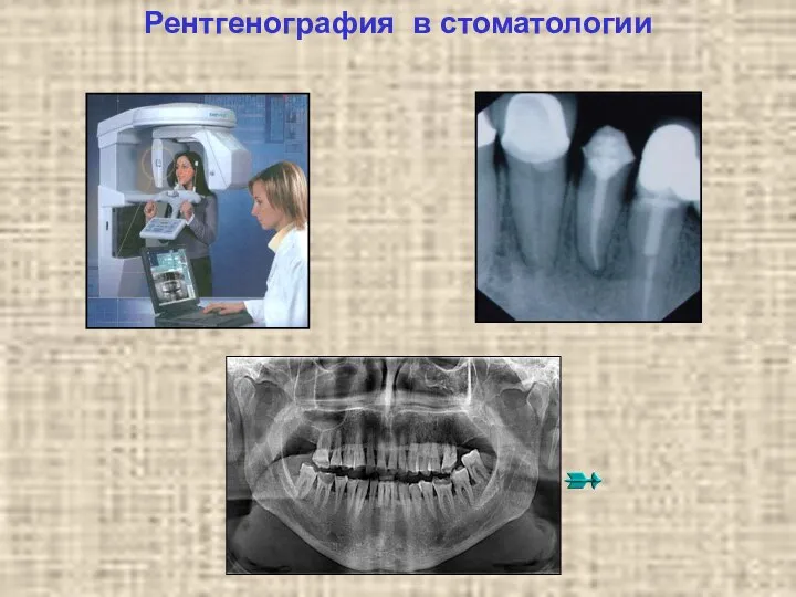 Рентгенография в стоматологии