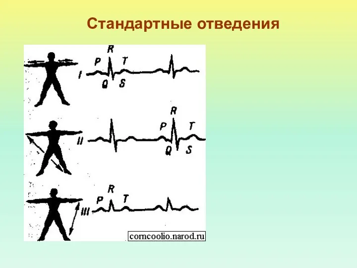 Стандартные отведения