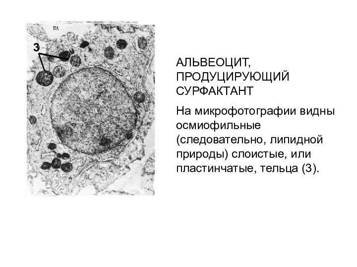 АЛЬВЕОЦИТ, ПРОДУЦИРУЮЩИЙ СУРФАКТАНТ На микрофотографии видны осмиофильные (следовательно, липидной природы) слоистые, или пластинчатые, тельца (3). 3