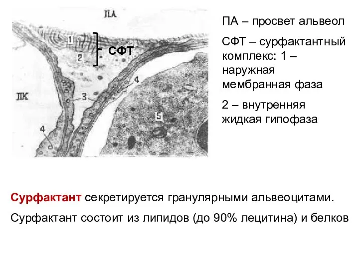 ПА – просвет альвеол СФТ – сурфактантный комплекс: 1 –наружная мембранная