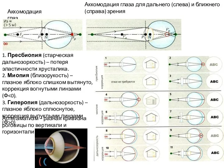 Аккомодация глаз Аккомодация глаза для дальнего (слева) и ближнего (справа) зрения