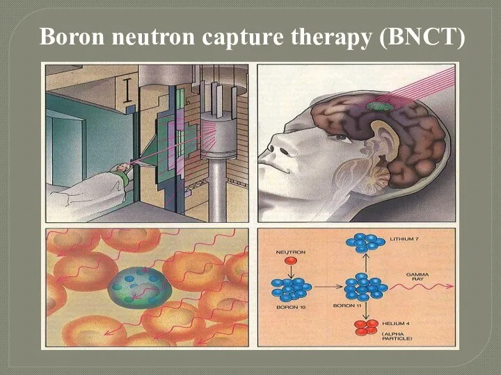 Вoron neutron capture therapy (BNCT)