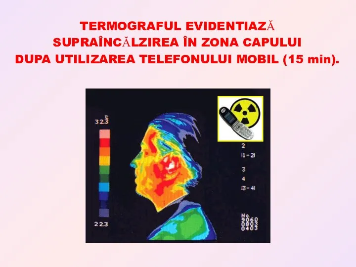 TERMOGRAFUL EVIDENTIAZĂ SUPRAÎNCĂLZIREA ÎN ZONA CAPULUI DUPA UTILIZAREA TELEFONULUI MOBIL (15 min).