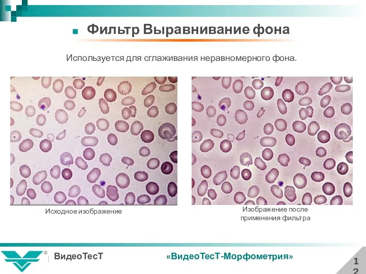 12 Фильтр Выравнивание фона Используется для сглаживания неравномерного фона. «ВидеоТесТ-Морфометрия» Исходное изображение Изображение после применения фильтра